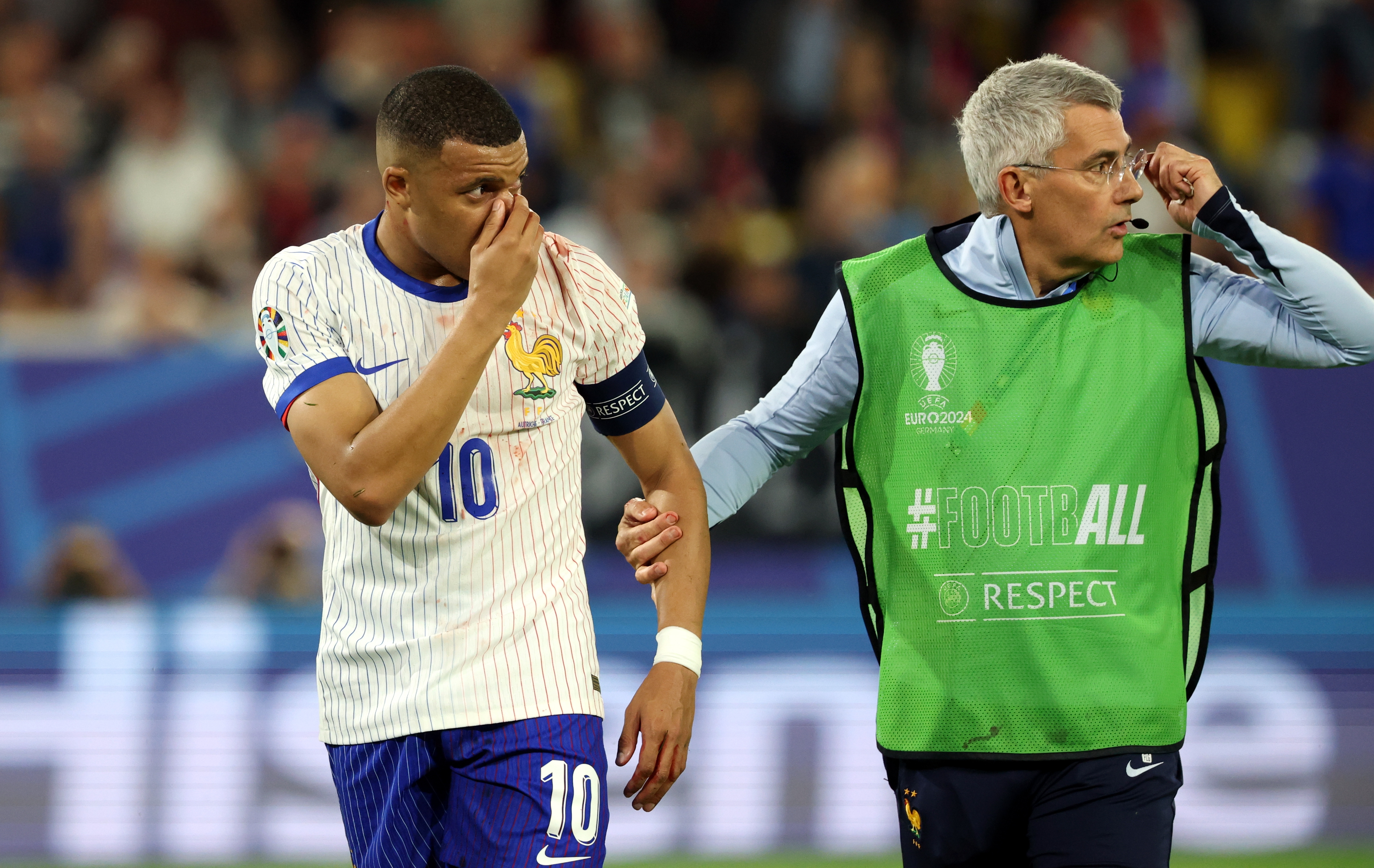 Mbappe will play with a special mask after broken nose against Austria