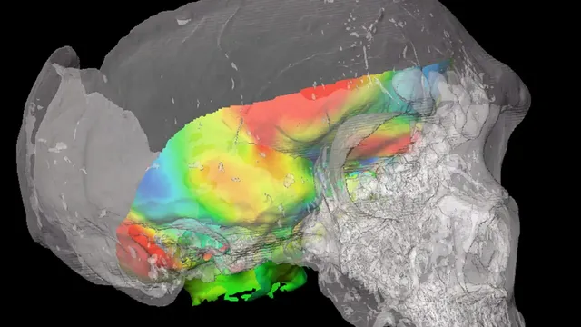 A drug that restores the brain after stroke has been created