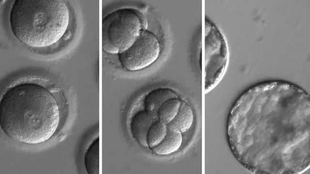 Revolution in DNA editing and the future of medicine